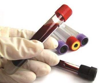 血脂高不高，“看脸”能知道！降血脂的饮食方式，值得掌握！ 