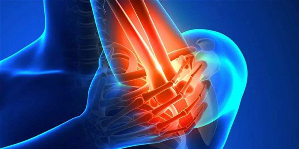 这六类人易患骨质疏松，小骨架的属于高危人群 