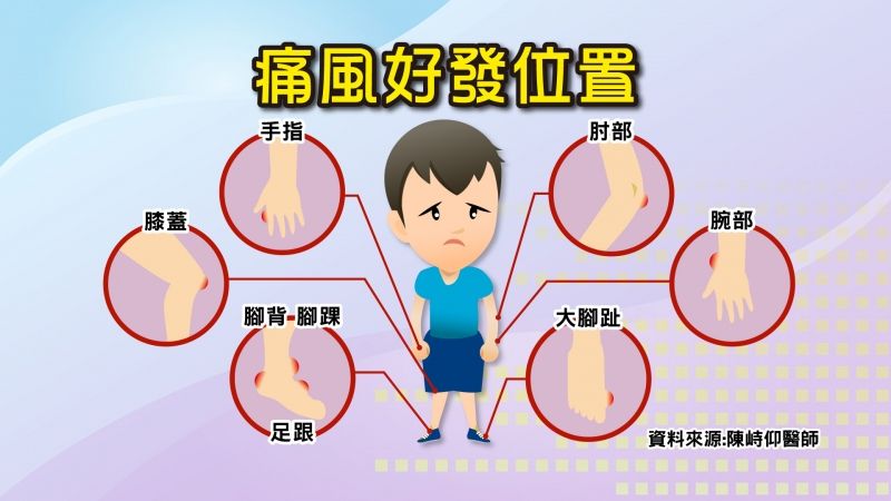 痛风治疗中 这些原则不可忽视！