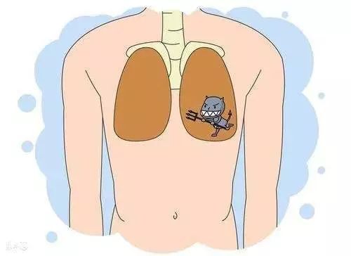 肺结节一定是肿瘤吗？发现肺结节应该怎么办呢？ 