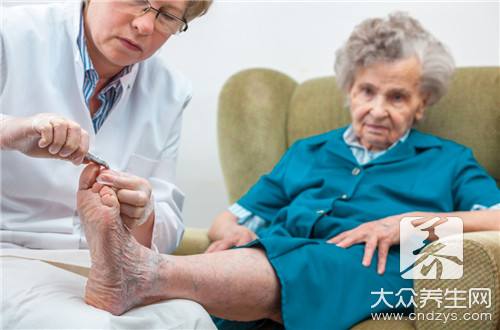 老人脚肿隐患多
