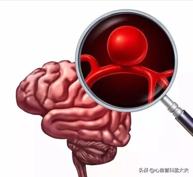 这些天，德云社一名年轻相声演员吴鹤臣因为脑出血，发起众筹捐款的事，上了热搜。然而大家热议的并不是为何这么年轻就脑出血了，而是众筹与他身份、收入及家庭的不匹配。  #青云计划##你好，立夏#  为什么脑出血越来越年轻化？医生：这3个因素是祸根！尽早远离 34岁的年龄，就脑出血，实属不应该  作为吃瓜群众的网友，也许根本想不到这种事情怎么会发生在自己身上？  也就是在差不多相同的时间，我们单位小周中午午休醒来，发现身体一侧发麻，并疼痛，无力，并伴有恶心、呕吐等情况。  开始以为中午趴在桌子上睡觉，压的，但是经