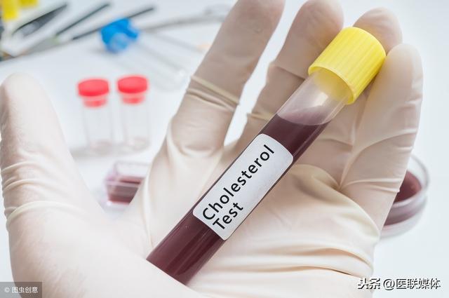 饮食已经够清淡了，甘油三酯还降不下来？怕是忽略了这一点