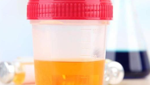 大小便出现这种变化，说明你的肝病开始恶化