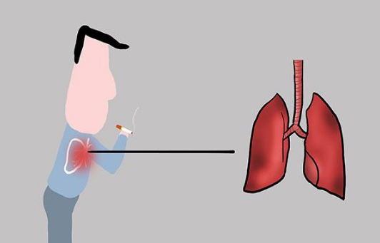 吸烟人群注意，身体有这些表现要重视，你的肺可能已经受损了