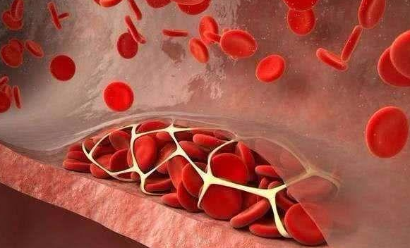 高血脂的人不适合吃什么？