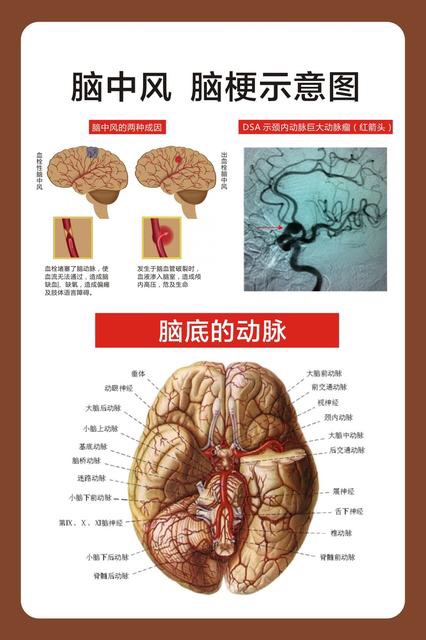 日本：脑中风等疾病死亡风险与摄取食物有关 风险或增3倍