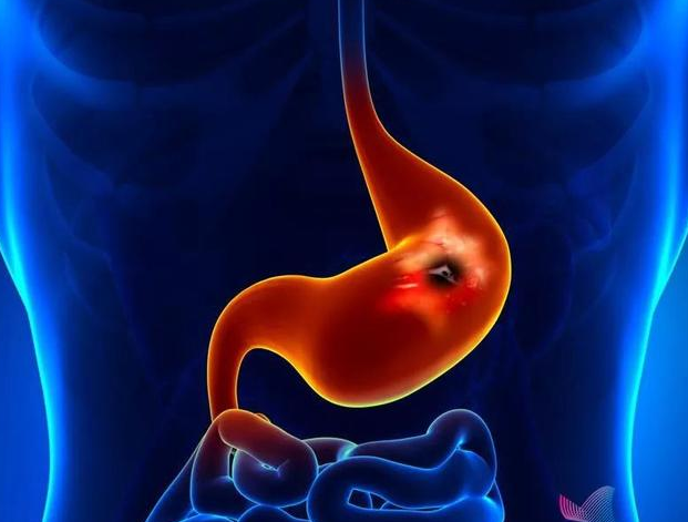 牙病会致癌！有这些症状的人，一定要小心