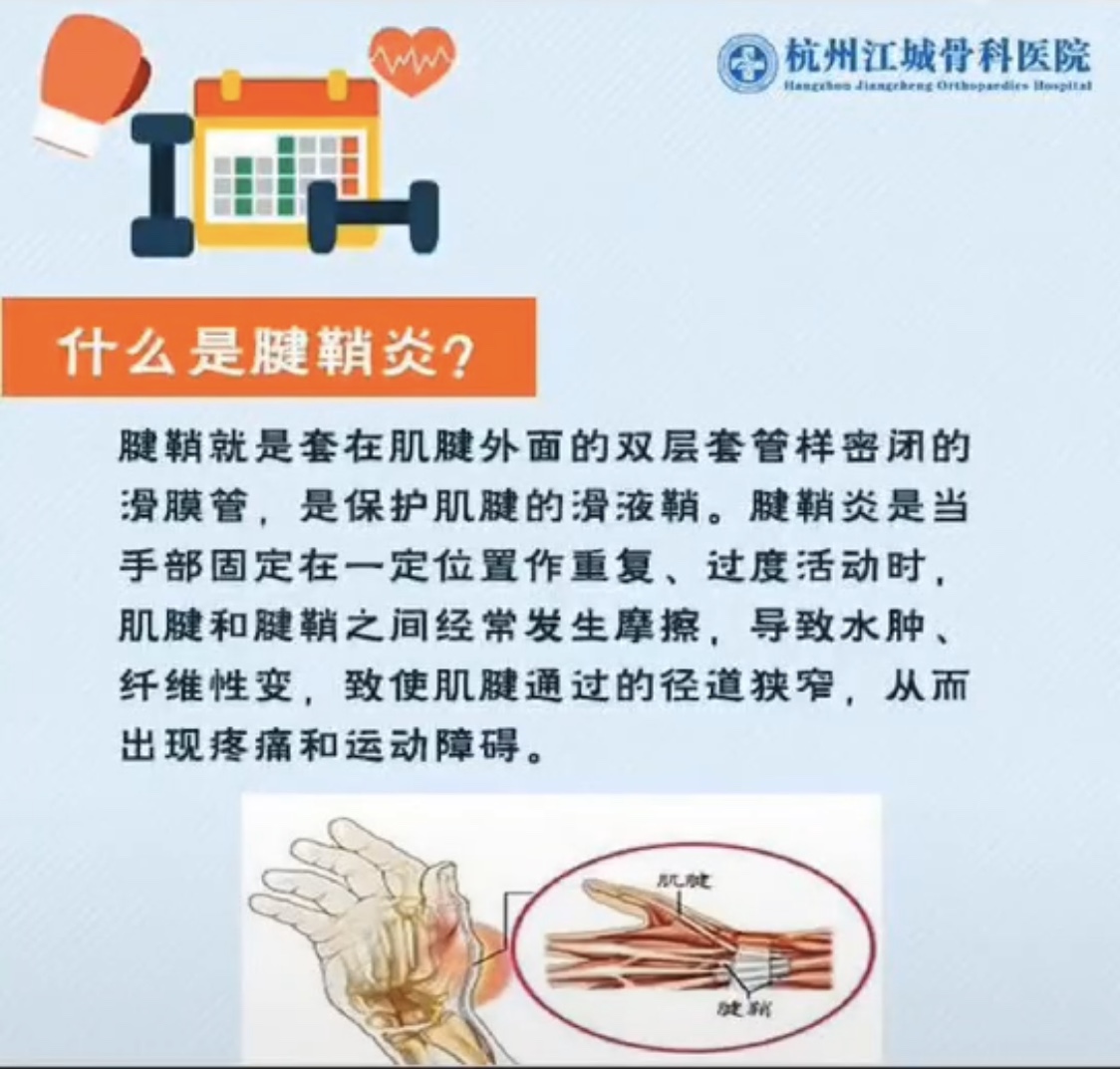 什么是腱鞘炎？