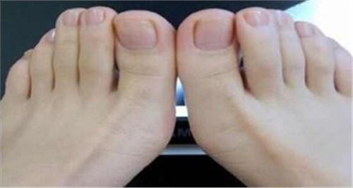 中医发现：不论男女，如果脚上有这个东西，你会长寿到一百多