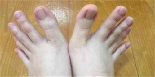 中医发现：不论男女，如果脚上有这个东西，你会长寿到一百多
