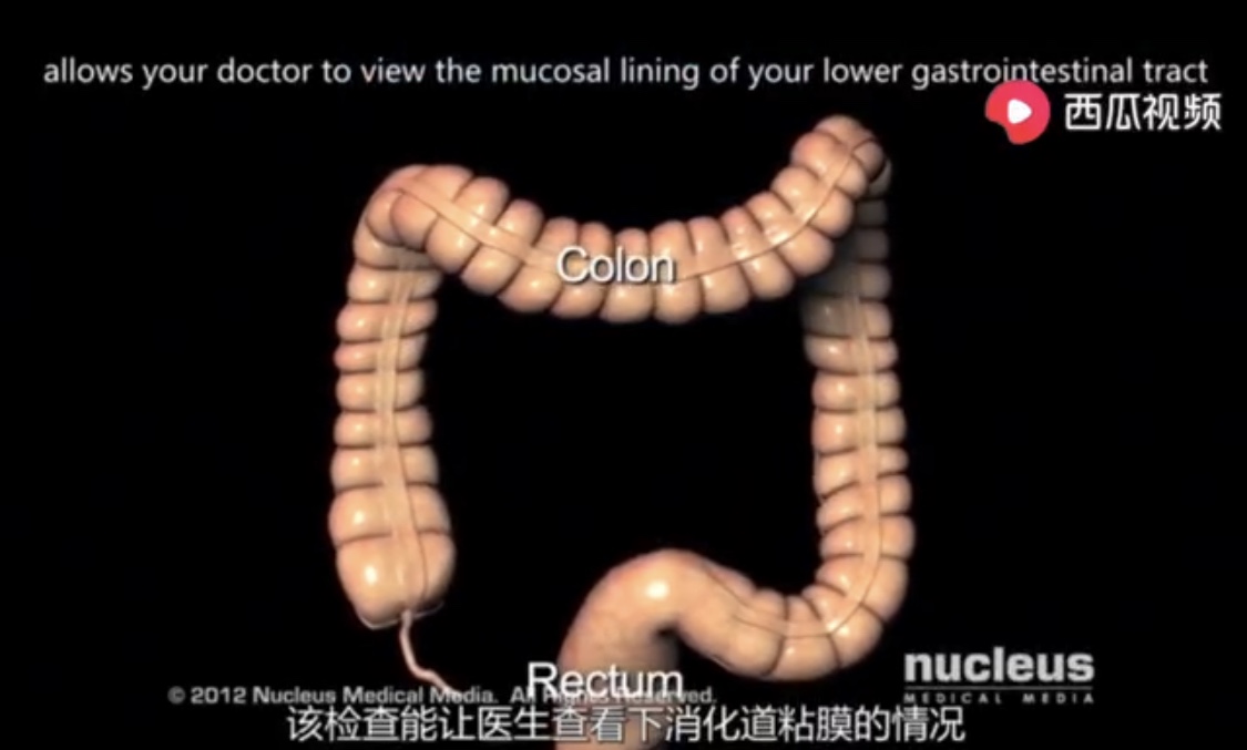 小视频 一个视频让你看懂肠镜是怎么做的