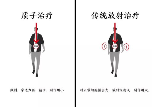 癌病患者的巨大福音---成都华西医院新建质子中心