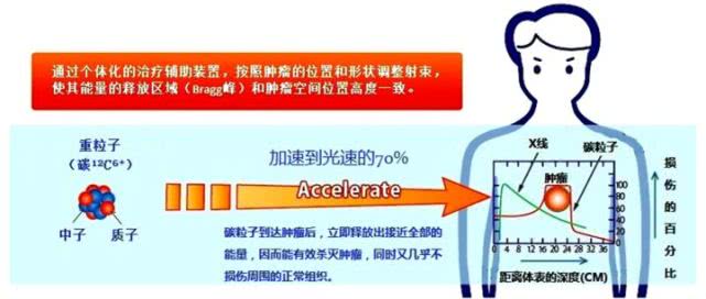 癌病患者的巨大福音---成都华西医院新建质子中心